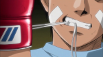 Counterpuncher